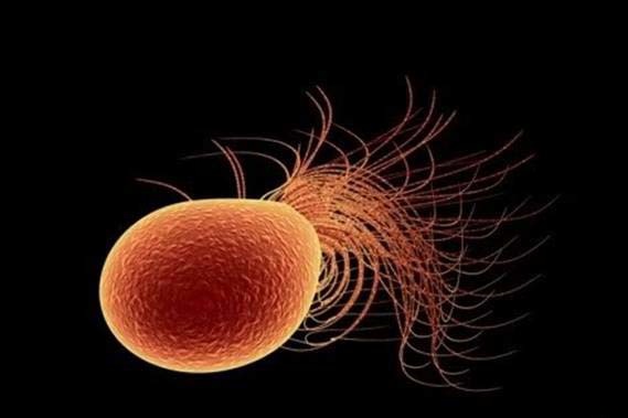 اکستروموفیل ها اکستروموفیل ها